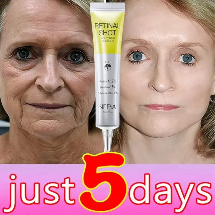 Retinol Anti-wrinkle Cream Collagen Anti-Aging Instant Removal Face Neck Wrinkle Efficient Moisturizing Firming Korean Skin Care - Image 3