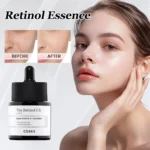 20ml Korea Facial Snail Essence The Niacinamide 15 Minimize Pores Seb Oil Control Serum The Retinol 0.5 Super Vitamin E Skincare - Image 5