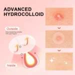 Hydrocolloid Acne Patches: Essential acne patches for every occasion | Invisible, breathable, and traceless, gentle on skin, wat - Image 3