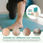 Reusable Invisible Silicone Scar Sheets Fast Healing Repair Strips Self-Adhesive Scar Cover Tape Effective Skin Care Strips - Image 2