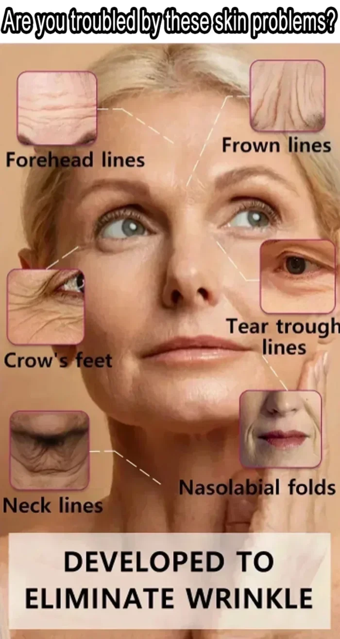 Instant Anti Wrinkle Aging Effect Remove Facial Wrinkles Serum To Fine Lines Around The Eyes Crow's Feet Neck Wrinkle Serum - Image 2