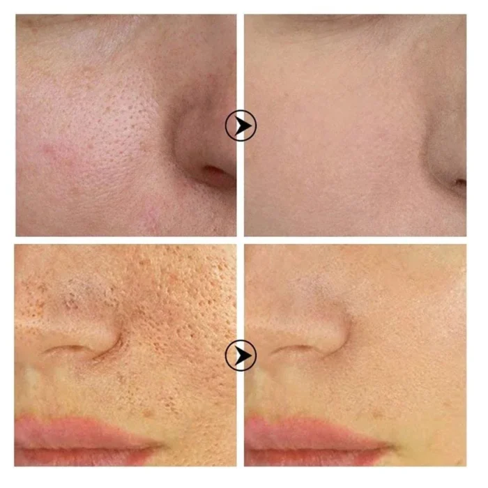 Skin Texture | Pore Refining Resurfacing, Brightening Facial Serum with Retinol and Niacinamide Non-Comedogenic - Image 6