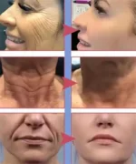 Retinol Anti-wrinkle Cream Collagen Anti-Aging Instant Removal Face Neck Wrinkle Efficient Moisturizing Firming Korean Skin Care - Image 2