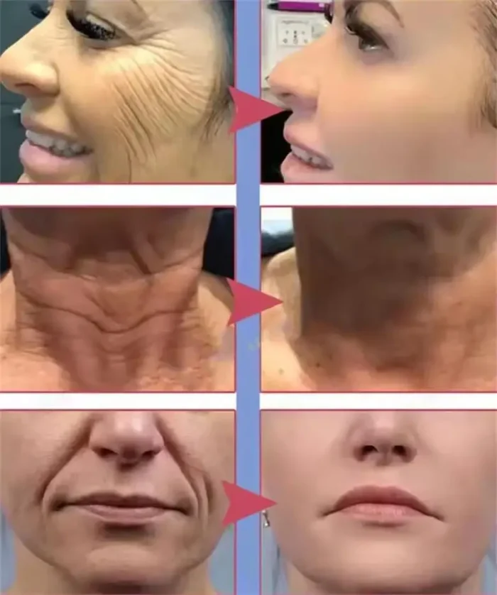 Retinol Anti-wrinkle Cream Collagen Anti-Aging Instant Removal Face Neck Wrinkle Efficient Moisturizing Firming Korean Skin Care - Image 2