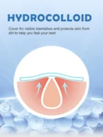 840 Hydrocolloid Star-Shaped Acne Patches/280 Patches | Absorbs pus and oil, cleanses and repairs acne-prone skin | Invisible wa - Image 4