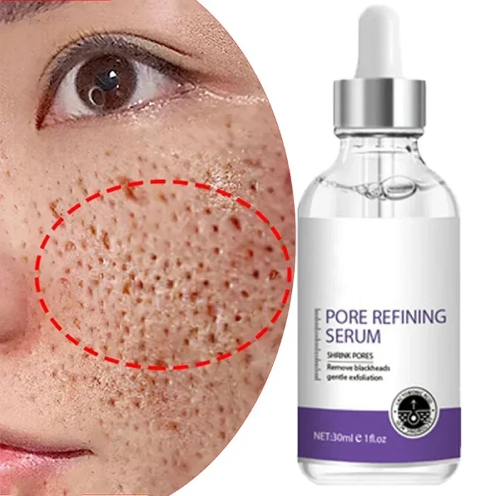 Skin Texture | Pore Refining Resurfacing, Brightening Facial Serum with Retinol and Niacinamide Non-Comedogenic - Image 1
