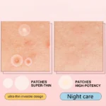 Hydrocolloid Acne Patches: Essential acne patches for every occasion | Invisible, breathable, and traceless, gentle on skin, wat - Image 5